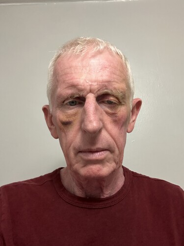 Colin Bailes Profile