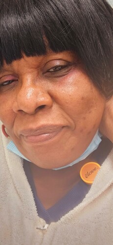 Waveney Lander Profile